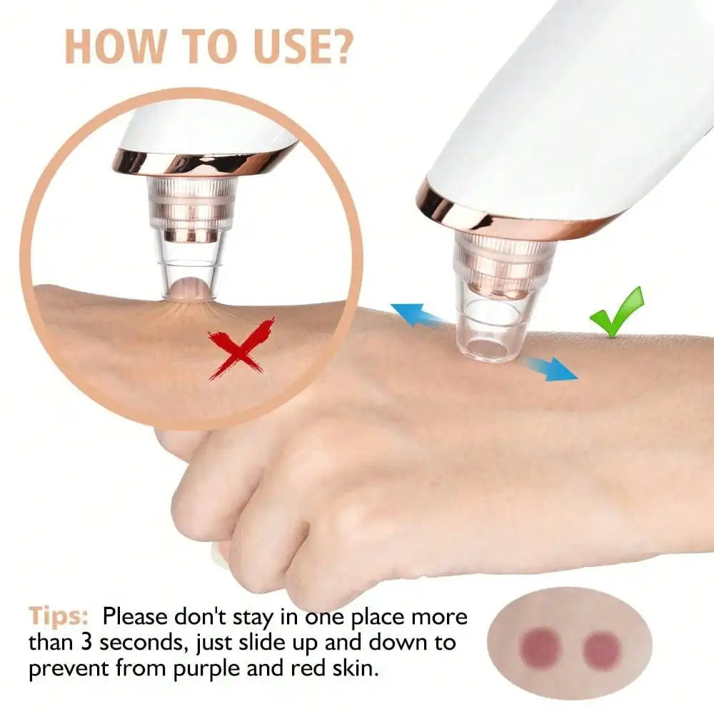 5 in 1 BLACK HEADS ACNE OIL REMOVER