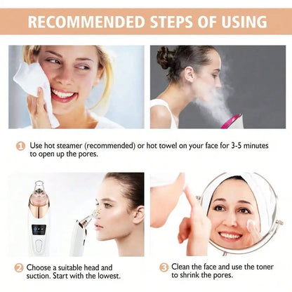5 in 1 BLACK HEADS ACNE OIL REMOVER